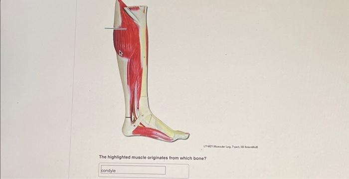 Solved The Highlighted Muscle Originates From Which Bone Chegg