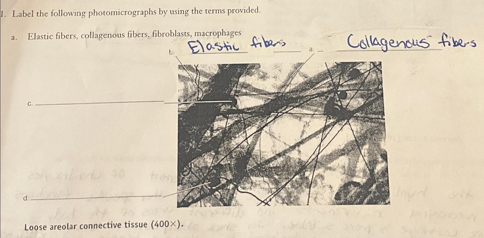 Solved Label The Following Photomicrographs By Using The Chegg