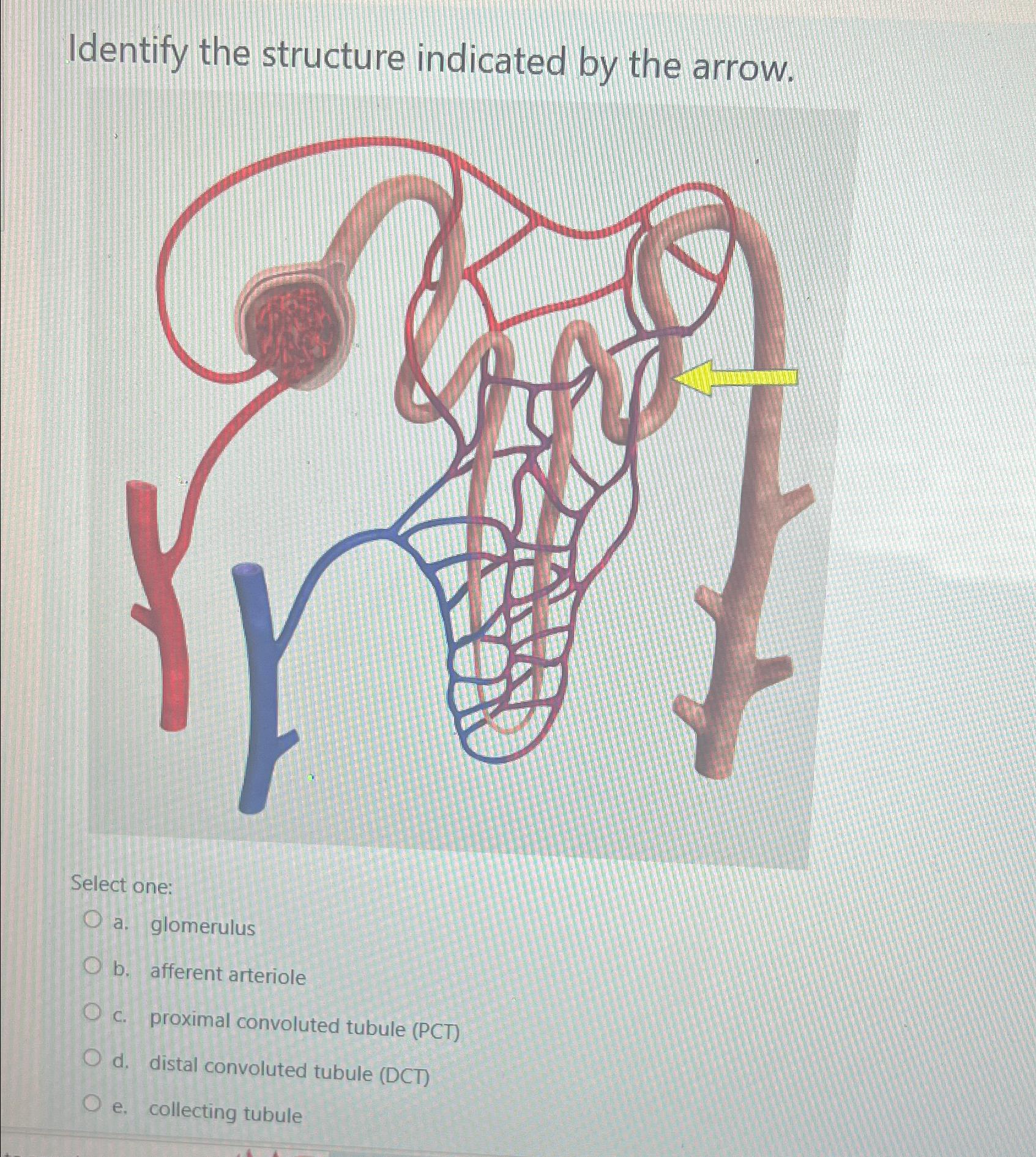 Solved Identify The Structure Indicated By The Arrow Select Chegg