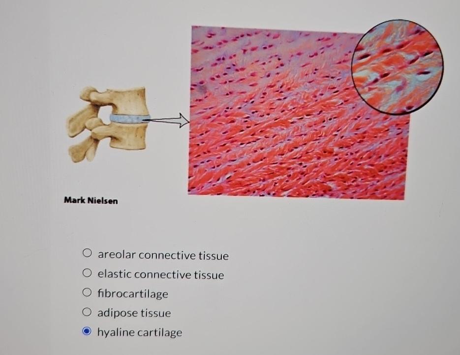 Solved Areolar Connective Tissueelastic Connective Chegg