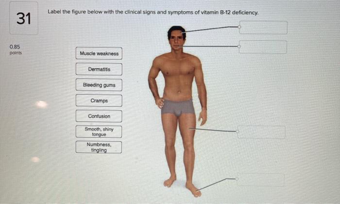 Solved Label The Figure Below With The Clinical Signs And Chegg