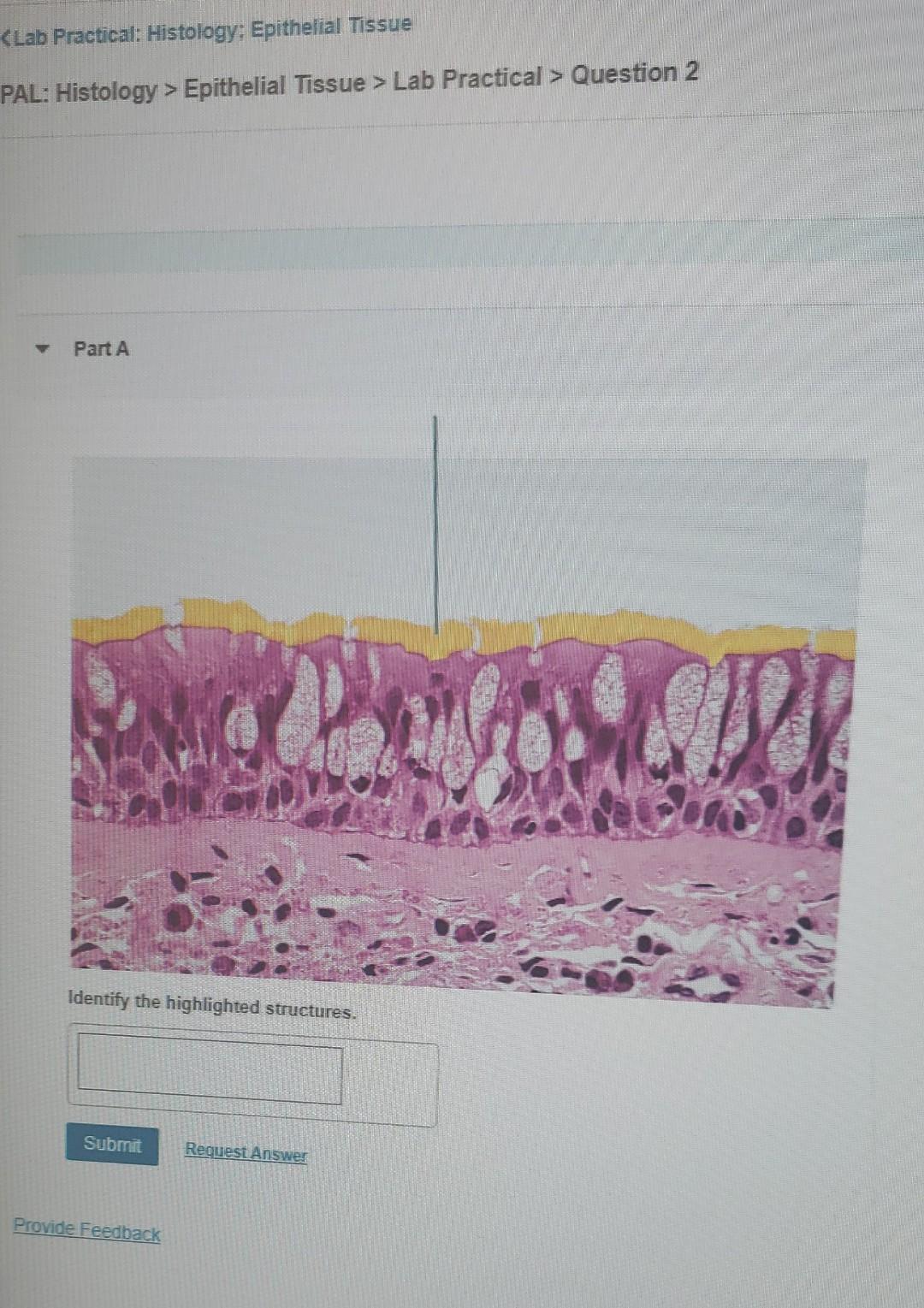 Solved Klab Practical Histology Epithelial Tissue Pal Chegg