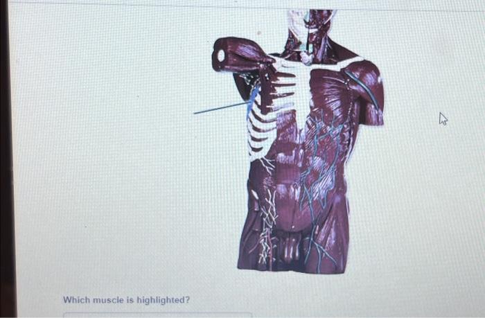 Solved Which Muscle Is Highlighted Chegg