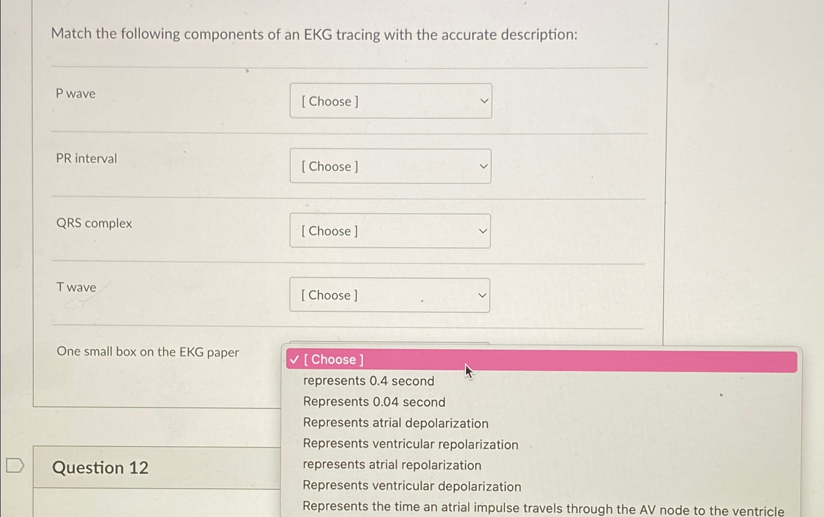 Solved Match The Following Components Of An EKG Tracing With Chegg