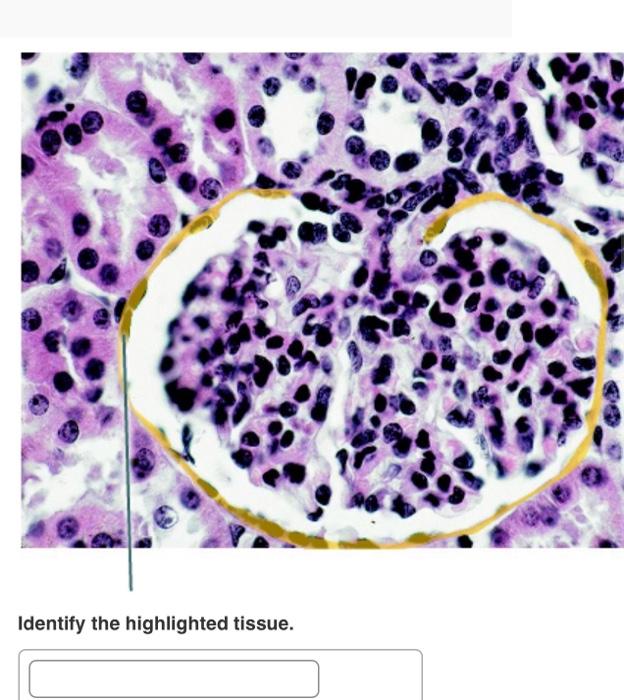 Solved Pal Histology Urinary System Lab Practical Chegg