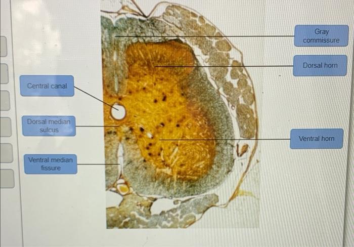 Solved Gray Commissure Dorsal Horn Central Canal Dorsal Chegg