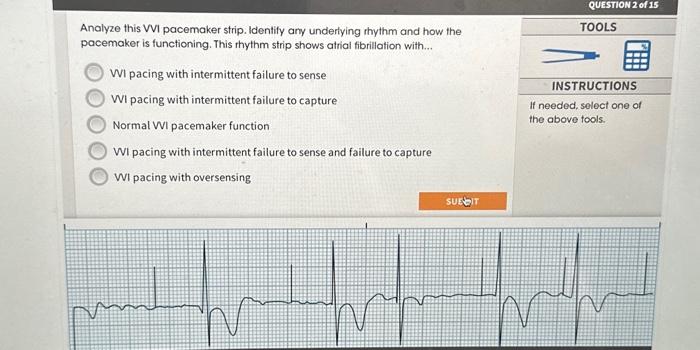 Solved Analyze This VVI Pacemaker Strip Identify Ary Chegg