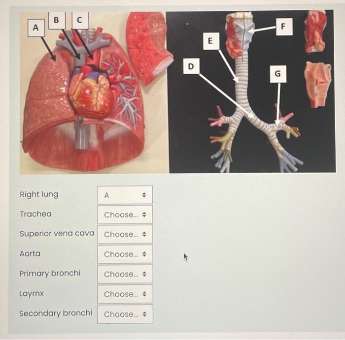 Solved Right Lung Trachea Superior Vena Cava Aorta Prima