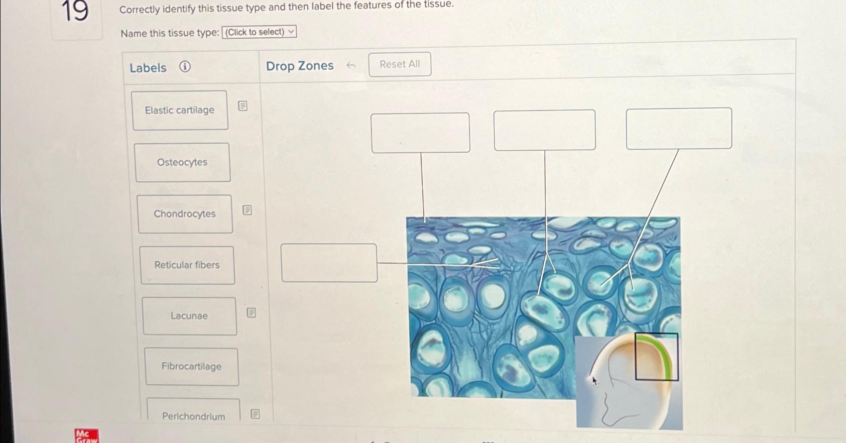 Solved 19 Correctly Identify This Tissue Type And Then Chegg