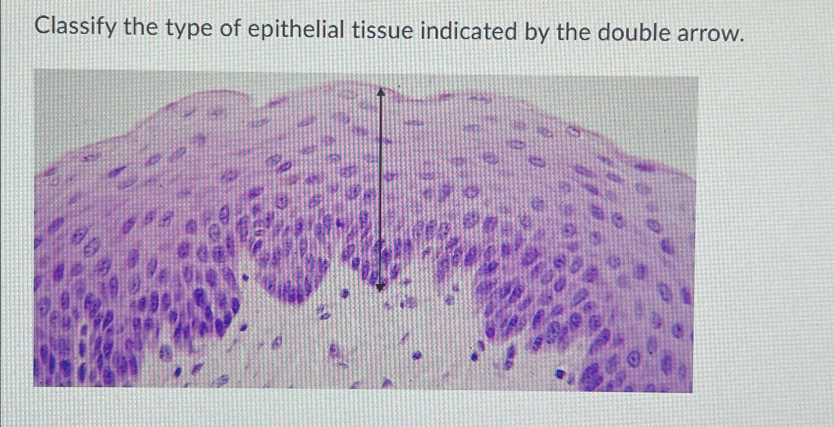 Solved Classify The Type Of Epithelial Tissue Indicated By Chegg