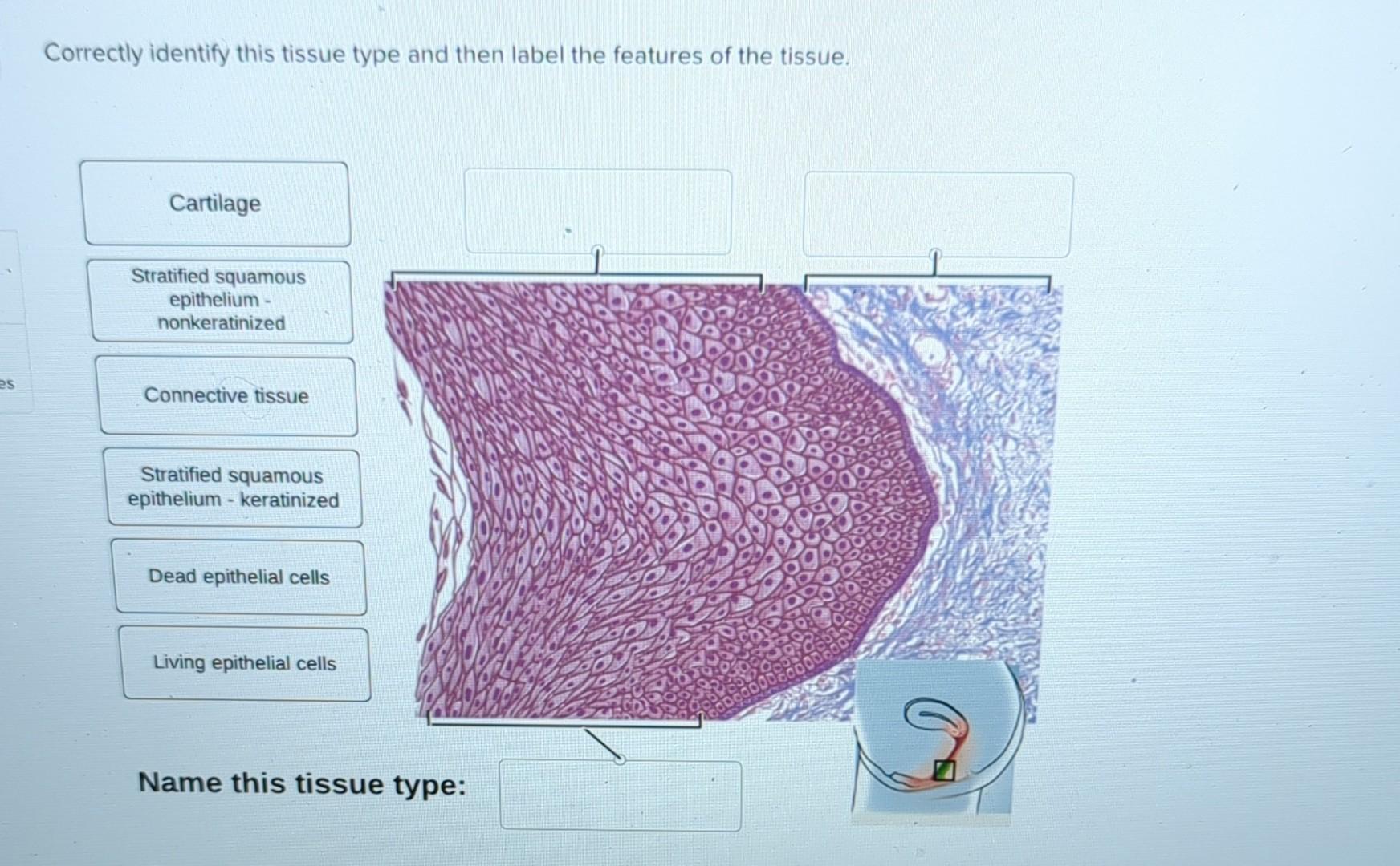 Solved Correctly Identify This Tissue Type And Then Label Chegg