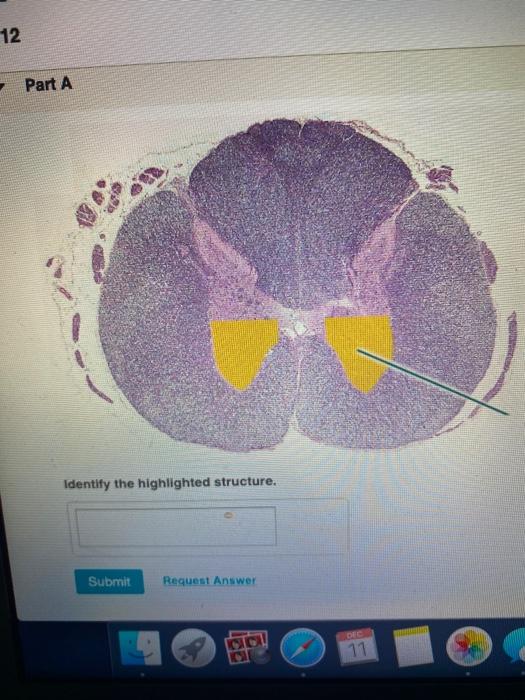 Solved Part A Identify The Highlighted Structure Submit Chegg