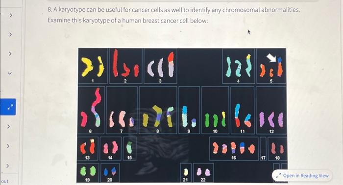 Solved A Karyotype Can Be Useful For Cancer Cells As Well Chegg