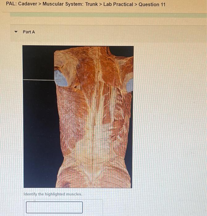 Solved Pal Cadaver Muscular System Trunk Lab Practical Chegg