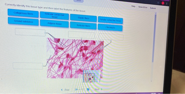 Solved Correctly Identify This Tissue Type And Then Label Chegg