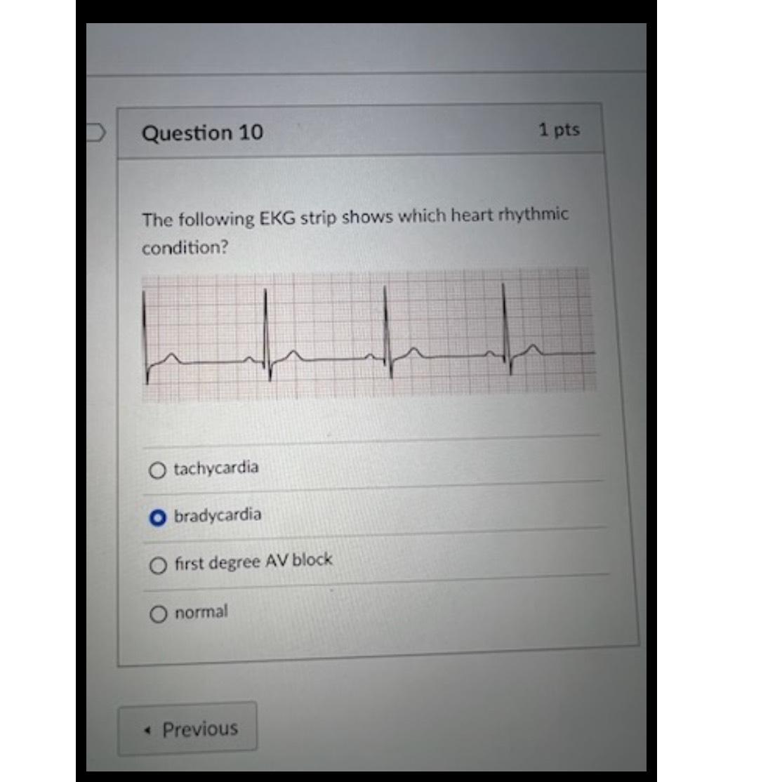 Solved Question 101 PtsThe Following EKG Strip Shows Which Chegg