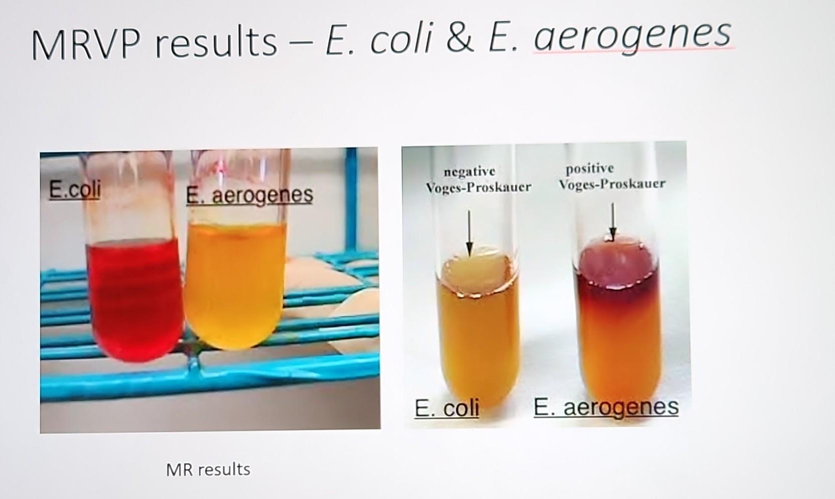 MRVP Results E Coli E Aerogenes IVIK Chegg