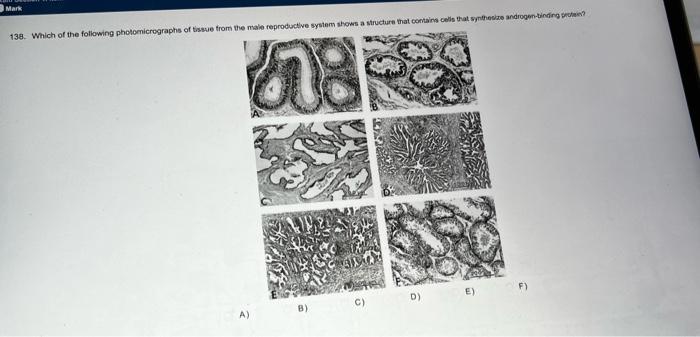 Solved Mark 138 Which Of The Following Photomicrographs Of Chegg