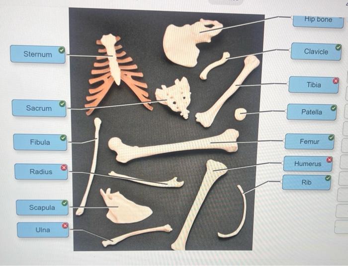 Solved Choose The Label Of The Surface Feature Bone Chegg