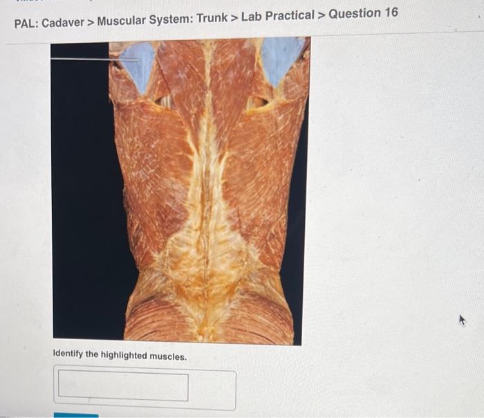 Solved Pal Cadaver Muscular System Upper Limb Lab Chegg