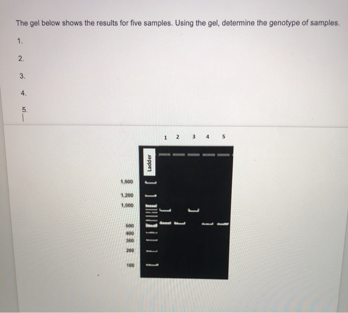 Solved The Gel Below Shows The Results For Five Samples Chegg