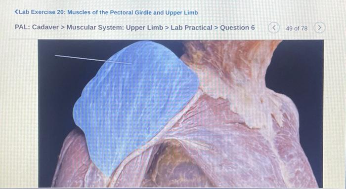 Solved Muscular System Upper Limb Lab Practical Chegg