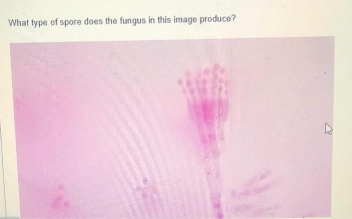 Solved What Type Of Spore Does The Fungus In This Image Chegg