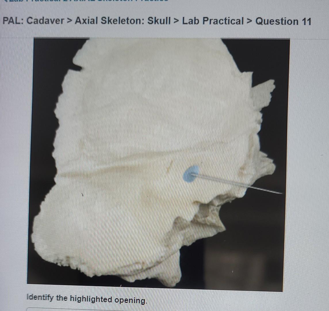 Solved PAL Cadaver Axial Skeleton Skull Lab Practical Chegg