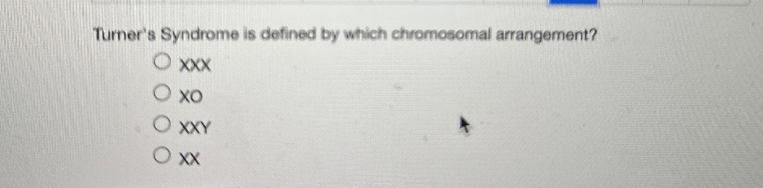 Solved Turner S Syndrome Is Defined By Which Chromosomal Chegg