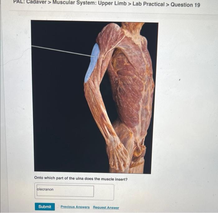 Solved PAL Cadaver Muscular System Upper Limb Lab Chegg