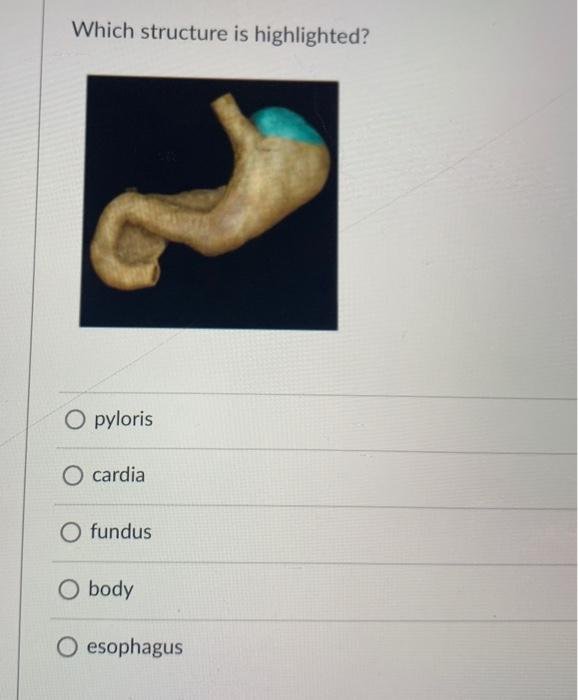 Solved Which Structure Is Highlighted Pyloris Cardia Fundus Chegg