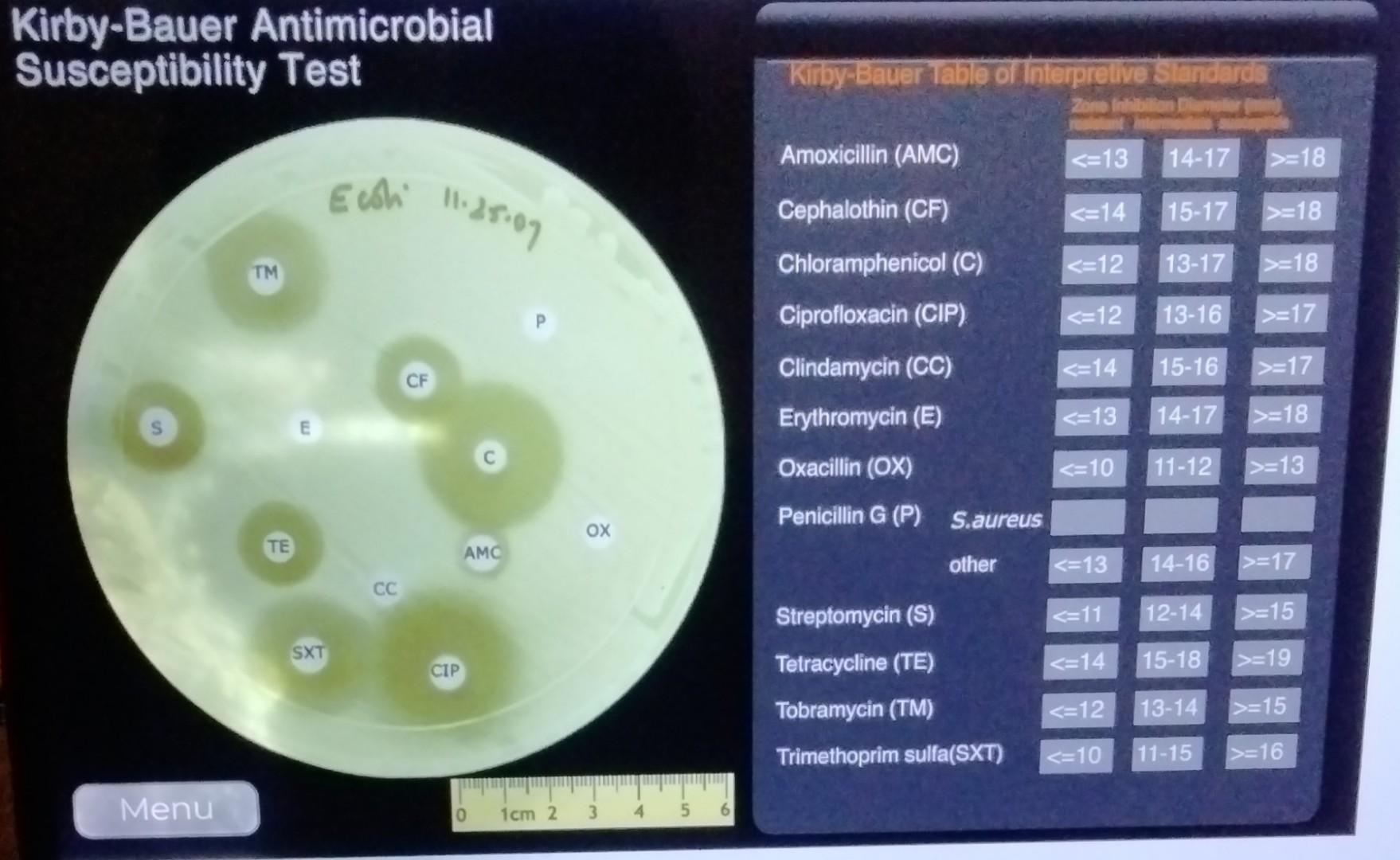 Kirby Bauer Antimicrobial Susceptibility Test Chegg