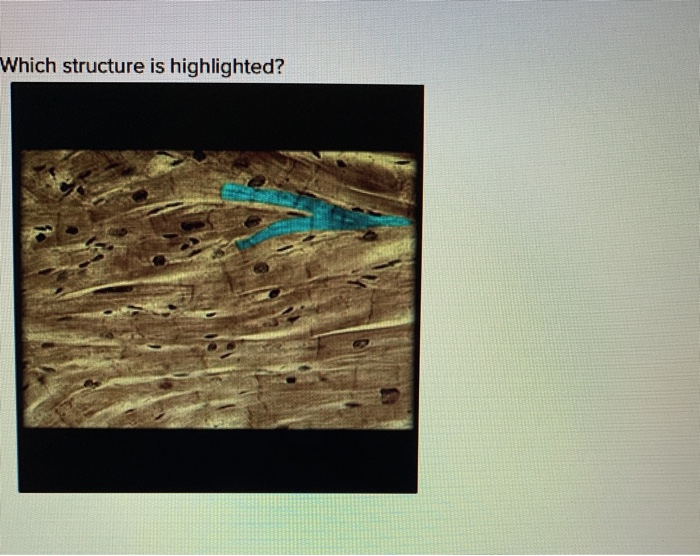 Solved Which Structure Is Highlighted Multiple Choice Chegg