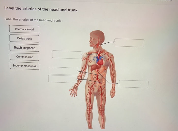 Solved Label The Arteries Of The Head And Trunk Label The Chegg