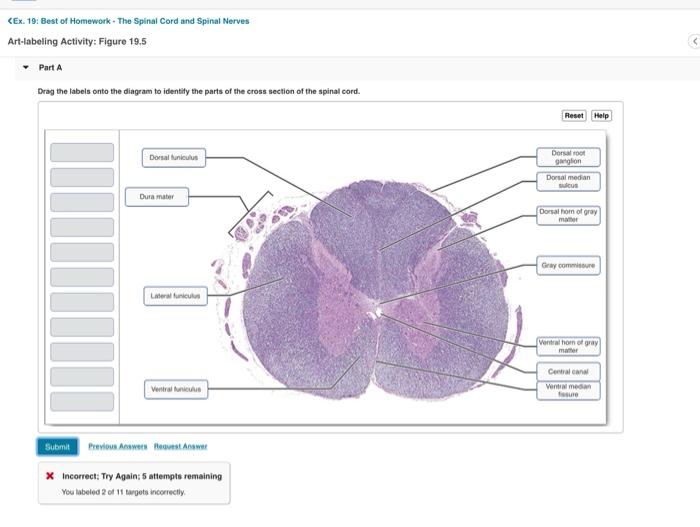 Solved EX 19 Best Of Homework The Spinal Cord And Chegg
