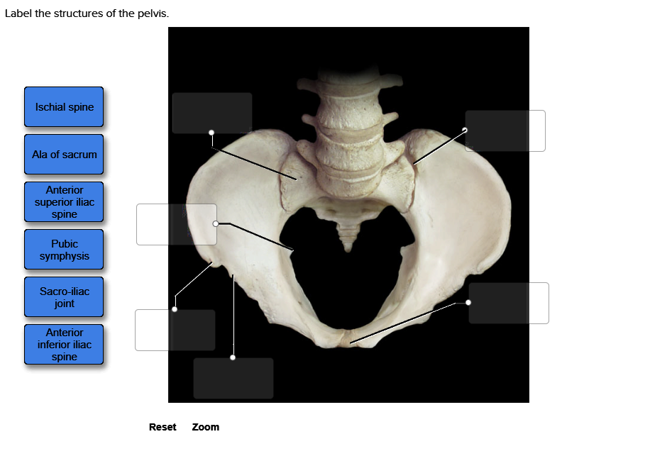 Solved Label The Structures Of The Pelvis Chegg