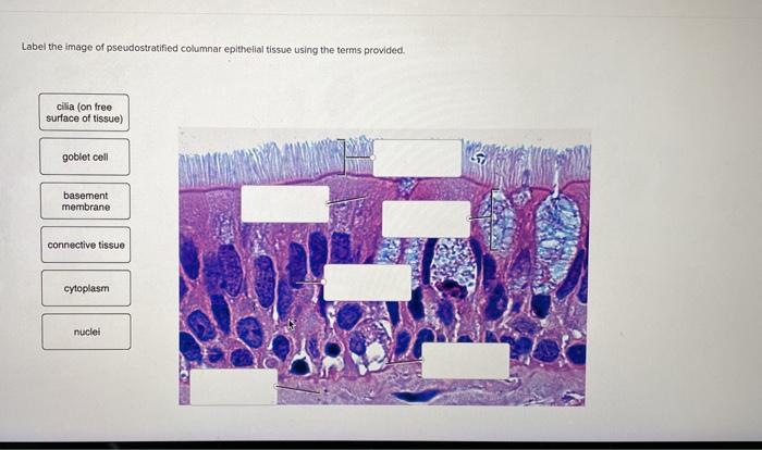 Question Label The Image Of Pseudostratified Columnar Epithelial