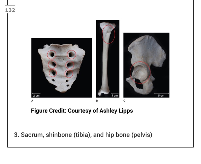 Solved Examine The Sacrum Shinbone Tibia And Hip Bone Chegg