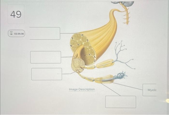 Solved Label The Connective Tissue Of A Peripheral Nerve In Chegg