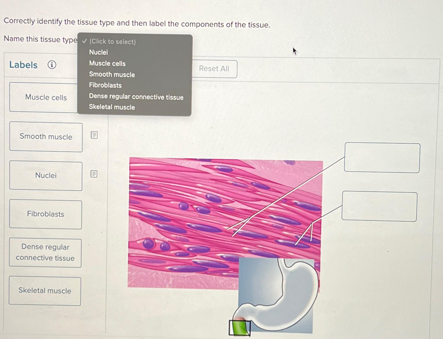 Solved Correctly Identify The Tissue Type And Then Label The Chegg