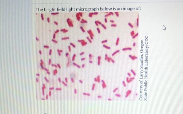 Solved Gram Positive Bacterial Cells Gram Negative Chegg