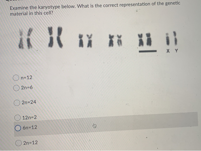 Solved Examine The Karyotype Below What Is The Correct Chegg