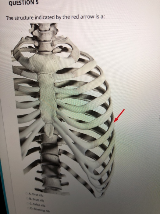 Solved The Structure Indicated By The Red Arrow Articulates Chegg