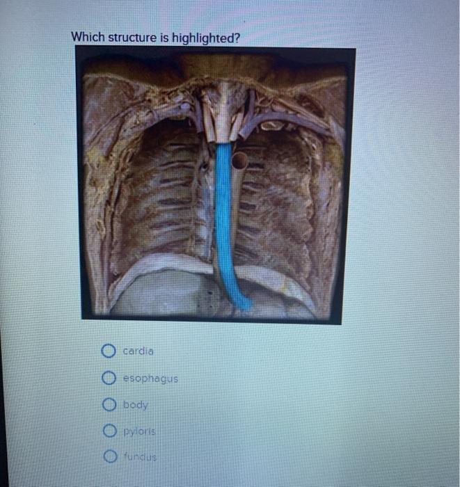 Solved Which Structure Is Highlighted Cardia Esophagus Body Chegg