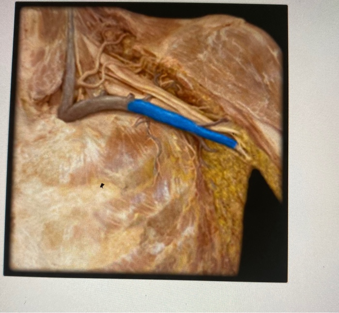 Solved Which Structure Is Highlighted Dorsal Artery Chegg