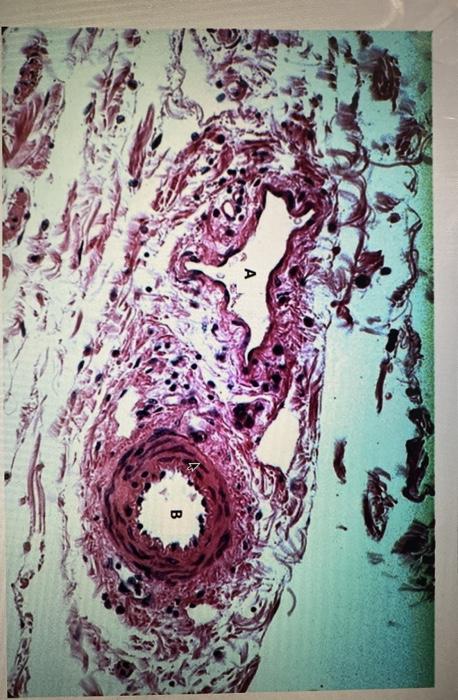 Solved Identify The Blood Vessels Based On Their Histology Chegg