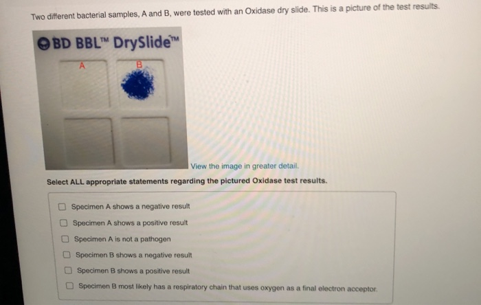 Solved Two Different Bacterial Samples A And B Were Tested Chegg