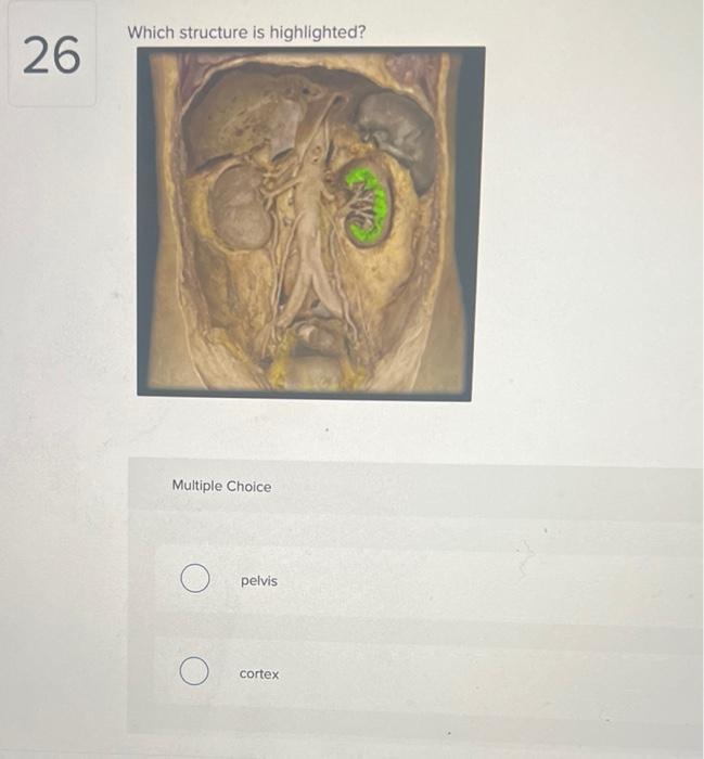 Solved Which Structure Is Highlighted Multiple Choice Chegg