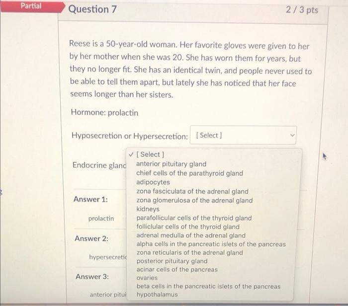 Solved Partial Question 2 2 4 Pts Determine The Type Of Chegg