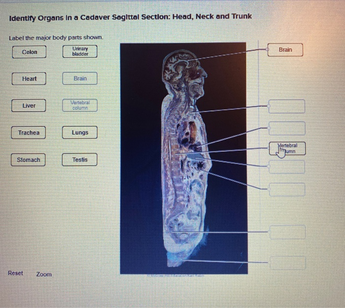 Solved Identify Organs In A Cadaver Soglttal Section Head Chegg